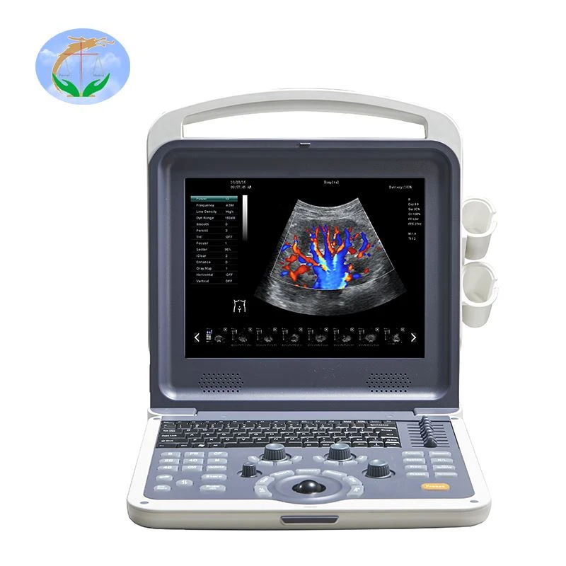 Color Doppler Color Doppler
