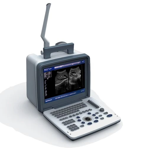 B/W Ultrasound Machine
