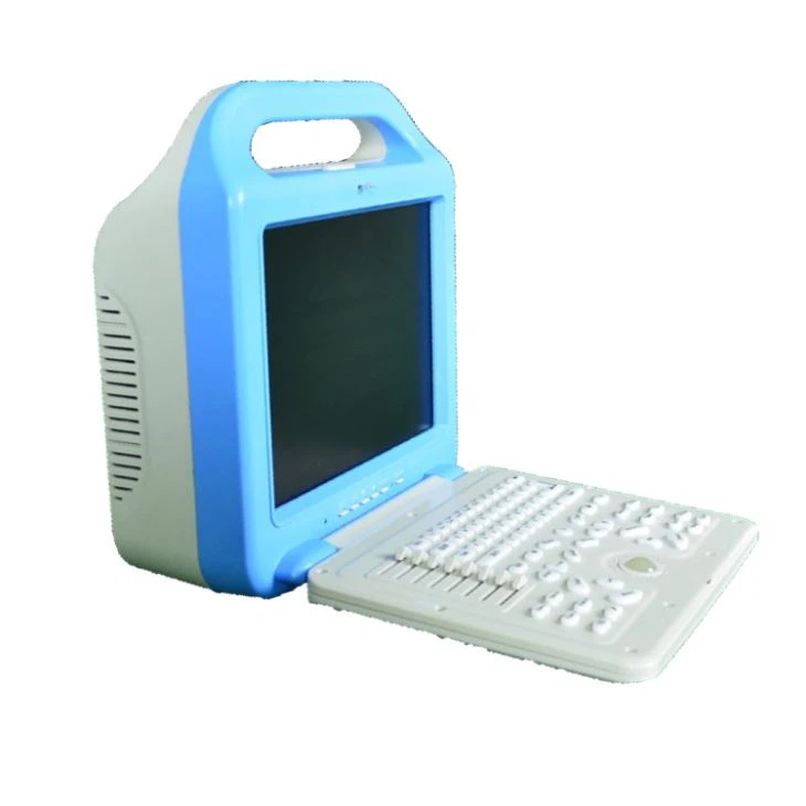 B/W Abdominal Portable Ultrasound Scanner