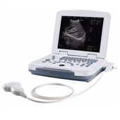 B/W nešiojamojo kompiuterio ultragarso sistemos skaitytuvas