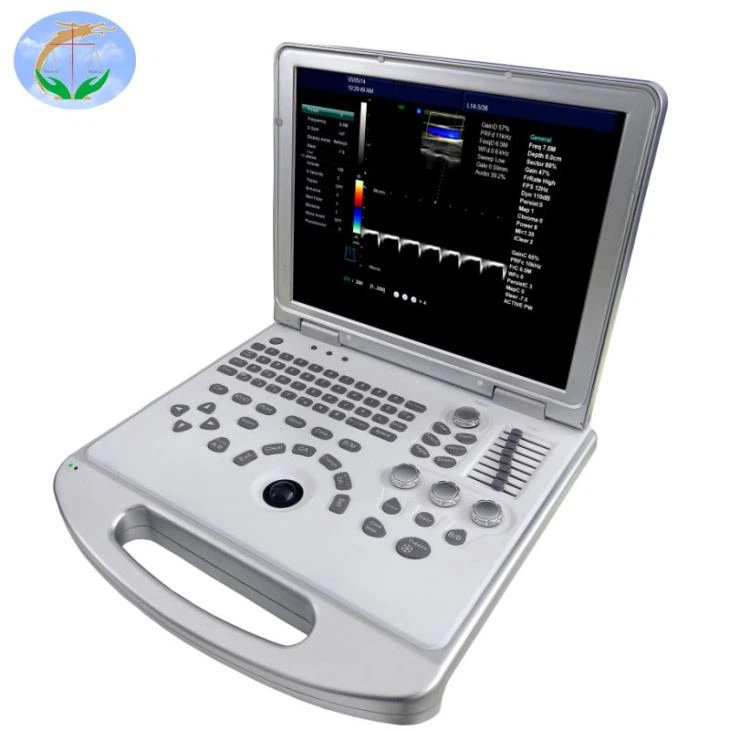 Portable Ultrasound Scanner