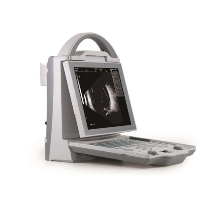 Ophthalmic Ultrasonic A/B Scan