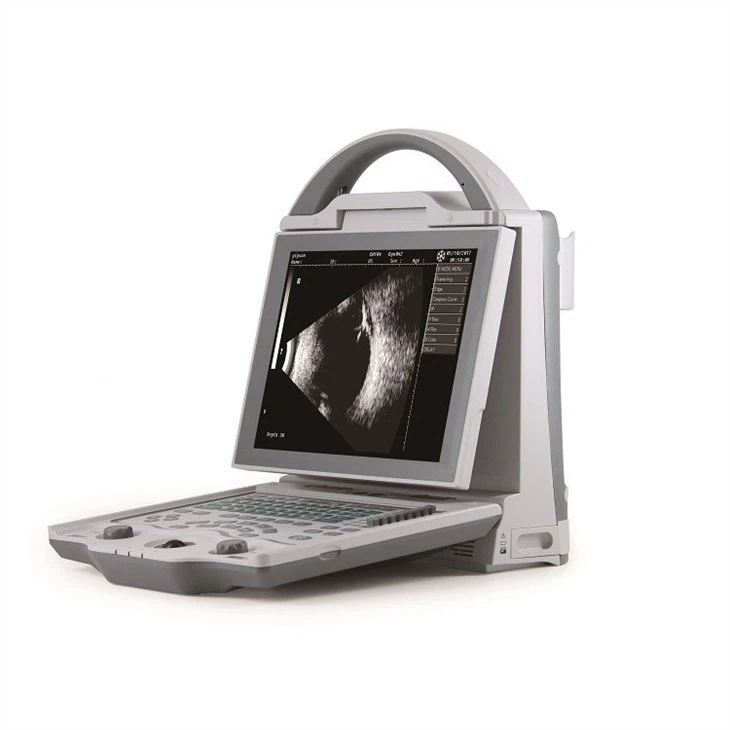 Ophthalmic Ultrasonic A/B Scan