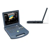 Nešiojamojo kompiuterio spalvotas Doplerio ultragarso aparatas