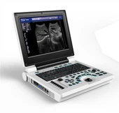 Pilnas skaitmeninis nešiojamas ultragarsas