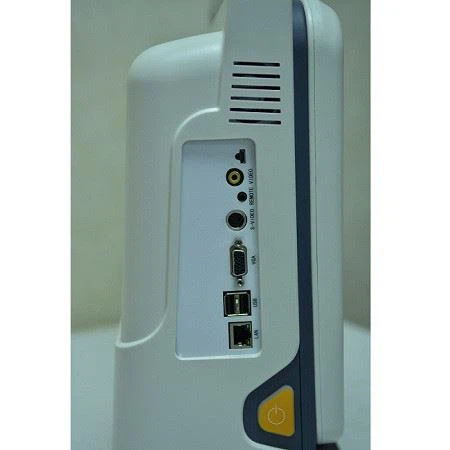 Hot Sale 2d Ultrasound Scanner Color Doppler Medical Portable Usg