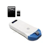 Mini rankinis ultragarsinis belaidis zondas 10-14Mhz 128 Elements B/W Version Wireless Handheld Ultragarso Linear Probe Machine